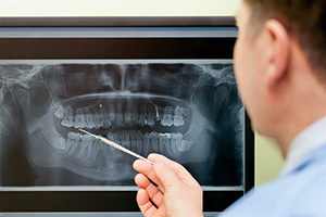 digital x-rays photo