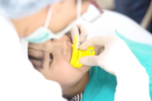 dental sealants photo