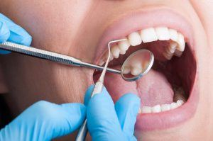dental cleanings & exams photo