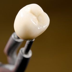 dental crowns photo