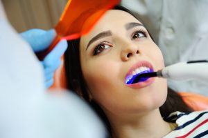 dental fillings photo